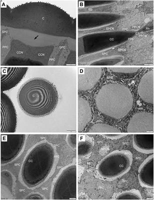 Fine structure of the compound eyes of the crepuscular moth Grapholita molesta (Busck 1916) (Lepidoptera: Tortricidae)